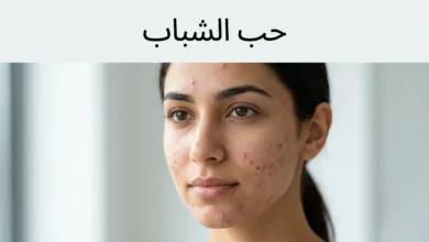 صورة غلاف واقعية لشخص عربي شاب مع حب شباب خفيف إلى متوسط ومساحة نظيفة تظهر عليها عبارة حب الشباب