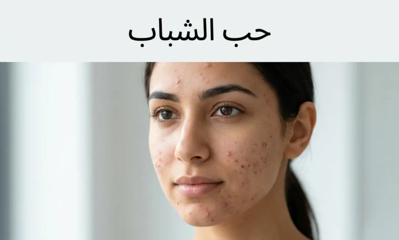 صورة غلاف واقعية لشخص عربي شاب مع حب شباب خفيف إلى متوسط ومساحة نظيفة تظهر عليها عبارة حب الشباب