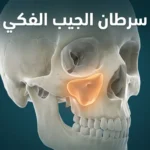 صورة توضيحية ثلاثية الأبعاد تُظهر موقع الجيب الفكي داخل عظام الجمجمة البشرية مع إبراز المنطقة المعرضة للإصابة بالسرطان