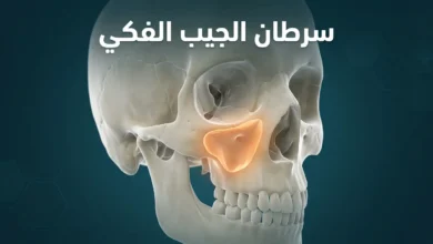 صورة توضيحية ثلاثية الأبعاد تُظهر موقع الجيب الفكي داخل عظام الجمجمة البشرية مع إبراز المنطقة المعرضة للإصابة بالسرطان
