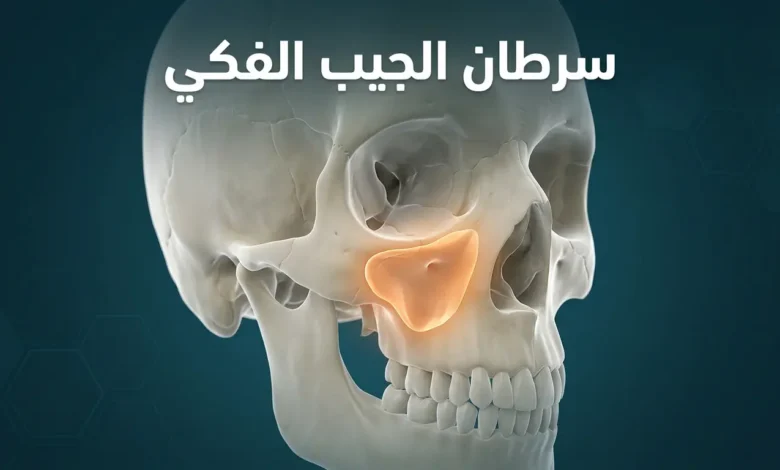 صورة توضيحية ثلاثية الأبعاد تُظهر موقع الجيب الفكي داخل عظام الجمجمة البشرية مع إبراز المنطقة المعرضة للإصابة بالسرطان