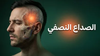 غلاف مقال الصداع النصفي يُظهر الجانب الأيسر من رأس إنسان مع تأثير شفاف يكشف الأوعية الدموية والأعصاب الملتهبة داخل الجمجمة وعبارة الصداع النصفي في المنتصف