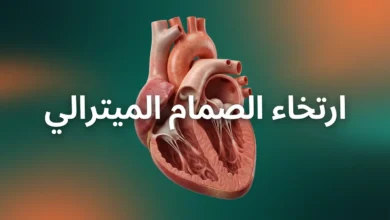 صورة غلاف توضيحية واقعية تُظهر قلبًا بشريًا تشريحيًا مع ارتخاء في الصمام الميترالي، مكتوب عليها ارتخاء الصمام الميترالي