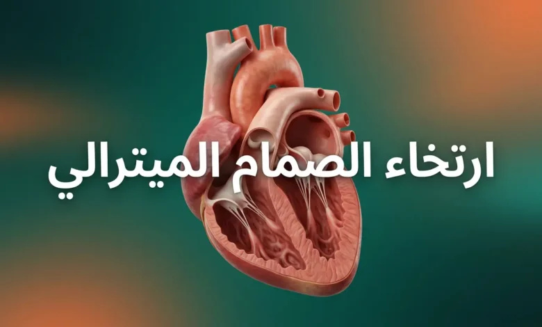 صورة غلاف توضيحية واقعية تُظهر قلبًا بشريًا تشريحيًا مع ارتخاء في الصمام الميترالي، مكتوب عليها ارتخاء الصمام الميترالي