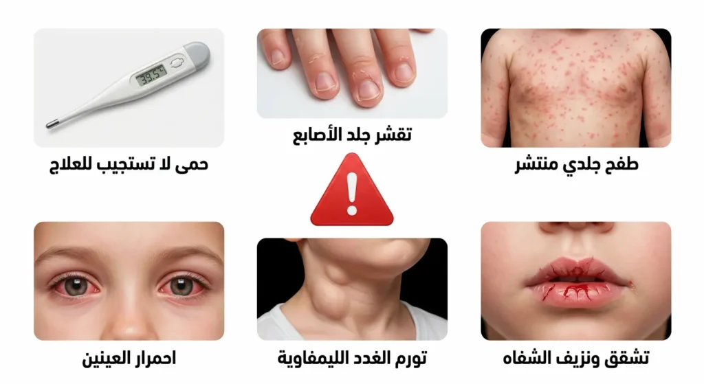 رسم توضيحي طبي واقعي يعرض ست علامات تحذيرية خطيرة تستدعي التوجه للطوارئ فوراً عند ظهورها مع لسان الفراولة عند الأطفال