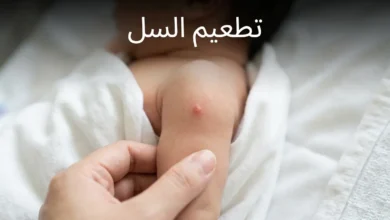 ذراع رضيع يُظهر مكان تطعيم السل BCG مع نتوء احمراري صغير طبيعي