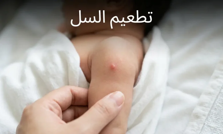 ذراع رضيع يُظهر مكان تطعيم السل BCG مع نتوء احمراري صغير طبيعي
