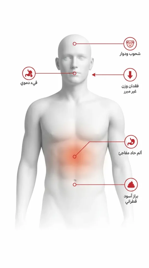 إنفوغرافيك طبي يعرض خمس علامات تحذيرية حمراء لمضاعفات قرحة المعدة على جسم بشري شبه شفاف