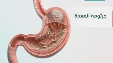 صورة غلاف طبية واقعية تُظهر المعدة من الداخل مع جرثومة المعدة داخل الطبقة المخاطية بشكل علمي نظيف.