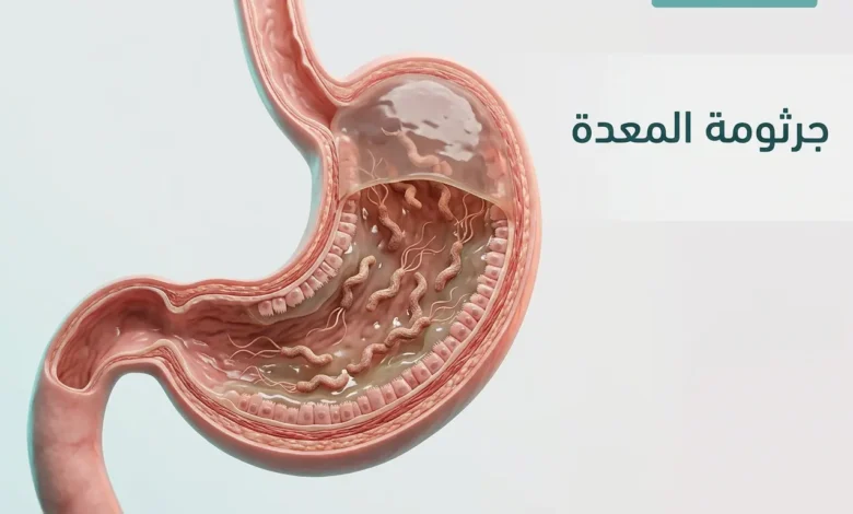 صورة غلاف طبية واقعية تُظهر المعدة من الداخل مع جرثومة المعدة داخل الطبقة المخاطية بشكل علمي نظيف.