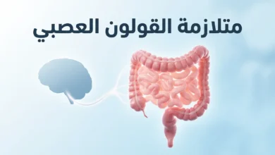 صورة غلاف توضح العلاقة بين الدماغ والقولون عبر المحور الدماغي المعوي مع عنوان متلازمة القولون العصبي