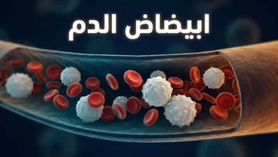 صورة غلاف مقال طبي عن ابيضاض الدم تُظهر خلايا دم داخل وعاء دموي بأسلوب ثلاثي الأبعاد واقعي