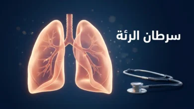 صورة غلاف توضيحية لمقال سرطان الرئة تُظهر رئتين بشريتين ثلاثيتي الأبعاد بجانب سماعة طبية مع عنوان سرطان الرئة