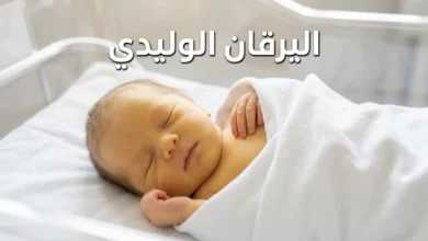رضيع نائم يظهر على بشرته اصفرار واضح دليل على اليرقان الوليدي