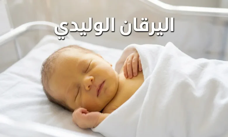 رضيع نائم يظهر على بشرته اصفرار واضح دليل على اليرقان الوليدي