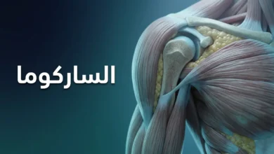 صورة غلاف مقال الساركوما تُظهر الأنسجة الضامة البشرية من عظام وعضلات ودهون مع كلمة الساركوما بالعربية.