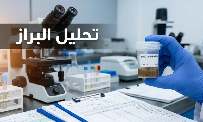 غلاف مقال تحليل البراز يُظهر يداً بقفاز طبي تمسك عينة مخبرية أمام خلفية مخبرية احترافية