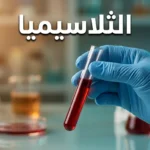أنبوب اختبار يحتوي على دم مع الكلمة المفتاحية الثلاسيميا على خلفية مختبر احترافية