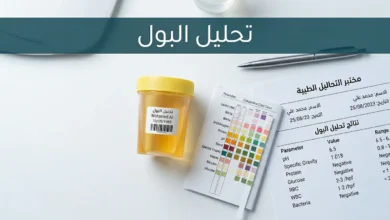 كوب عينة بول شفاف وشريط فحص كيميائي على طاولة مختبر طبية نظيفة