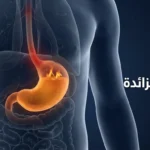 صورة غلاف توضيحية تُظهر جذعاً بشرياً شفافاً بداخله معدة متوهجة بلون كهرماني يمثل فرط حموضة المعدة مع نص عربي "حموضة المعدة الزائدة"