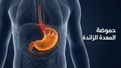 صورة غلاف توضيحية تُظهر جذعاً بشرياً شفافاً بداخله معدة متوهجة بلون كهرماني يمثل فرط حموضة المعدة مع نص عربي "حموضة المعدة الزائدة"