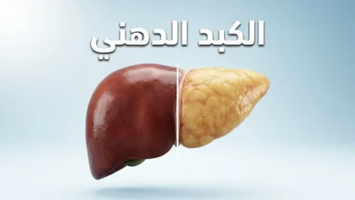 صورة ثلاثية الأبعاد واقعية تقارن بين كبد صحي بلون أحمر داكن وكبد دهني شاحب متضخم مع نص الكبد الدهني