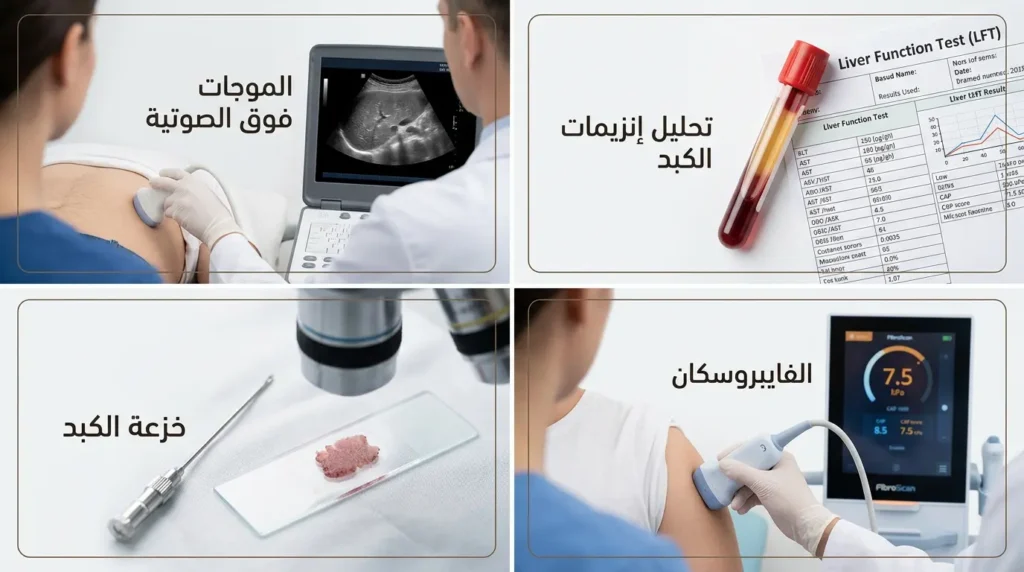 صورة واقعية تعرض أربع طرق لتشخيص الكبد الدهني: تحليل الدم والسونار والفايبروسكان وخزعة الكبد