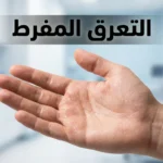 صورة غلاف تُظهر راحة يد بشرية مع قطرات عرق دقيقة على سطح الجلد وعبارة التعرق المفرط بالعربية في أعلى الصورة