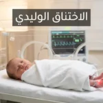 مولود حديث الولادة داخل حاضنة وحدة العناية المركزة مع جهاز مراقبة النبض يمثل حالة الاختناق الوليدي