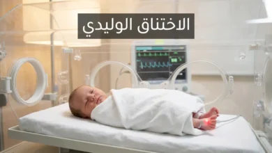 مولود حديث الولادة داخل حاضنة وحدة العناية المركزة مع جهاز مراقبة النبض يمثل حالة الاختناق الوليدي