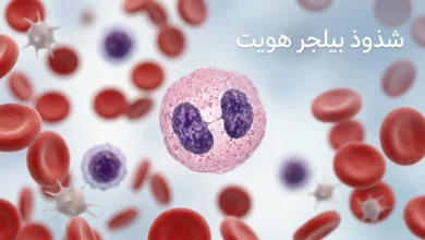 صورة غلاف طبية تُظهر خلية متعادلة ذات نواة ثنائية الفص تمثل شذوذ بيلجر هويت ضمن مشهد دموي نظيف وواقعي.