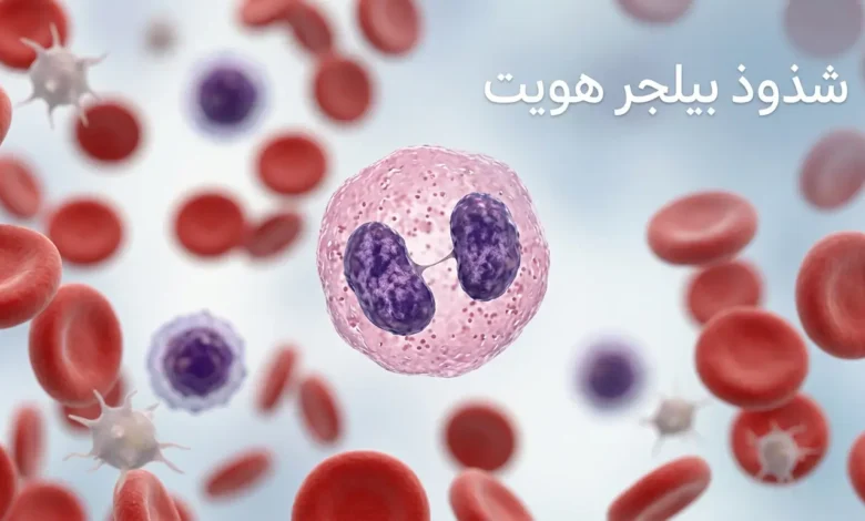 صورة غلاف طبية تُظهر خلية متعادلة ذات نواة ثنائية الفص تمثل شذوذ بيلجر هويت ضمن مشهد دموي نظيف وواقعي.