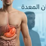 صورة غلاف طبية واقعية تُظهر المعدة داخل الجزء العلوي من الجسم مع عنوان سرطان المعدة