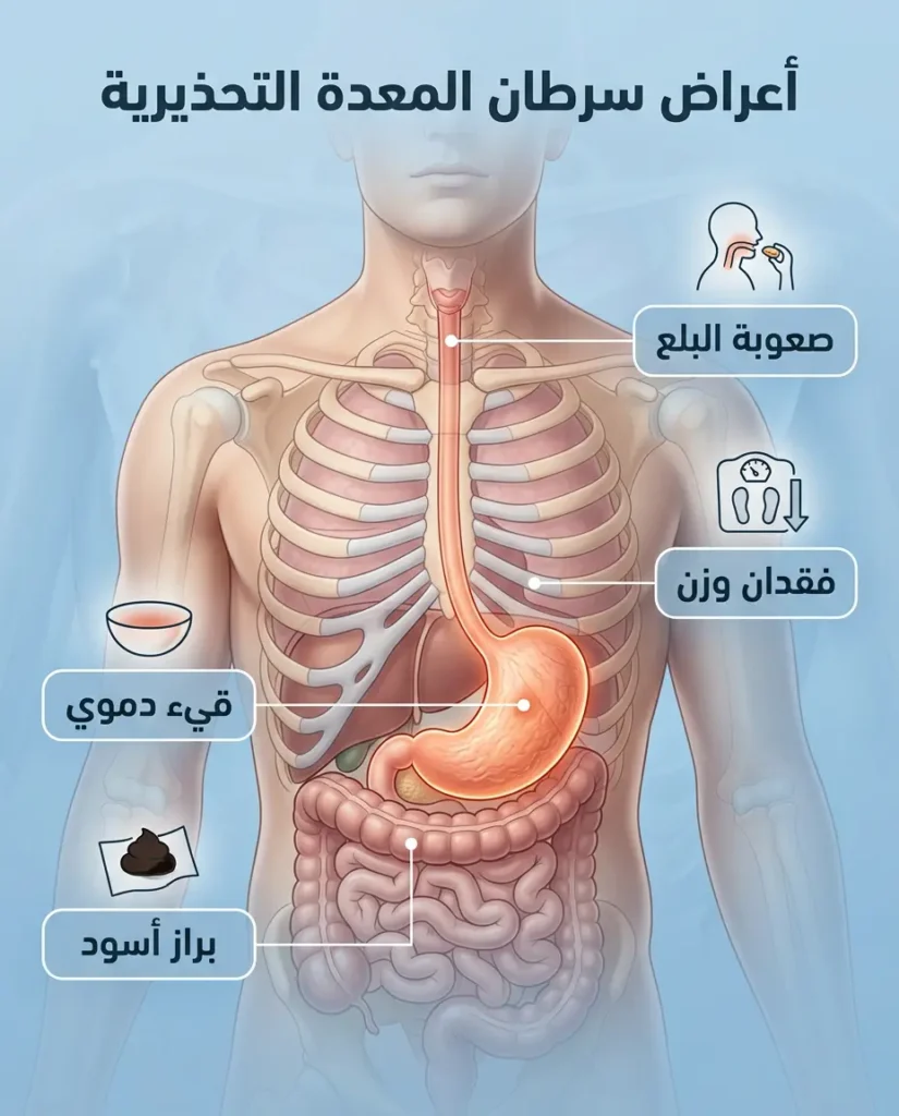 إنفوغرافيك طبي يوضح أهم علامات الإنذار في سرطان المعدة مثل فقدان الوزن وصعوبة البلع والقيء الدموي والبراز الأسود