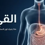 صورة غلاف طبية تعرض نموذجاً ثلاثي الأبعاد للجهاز الهضمي العلوي مع عنوان المقال عن القيء ودلالات ألوان الاستفراغ