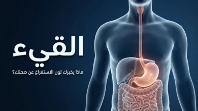 صورة غلاف طبية تعرض نموذجاً ثلاثي الأبعاد للجهاز الهضمي العلوي مع عنوان المقال عن القيء ودلالات ألوان الاستفراغ