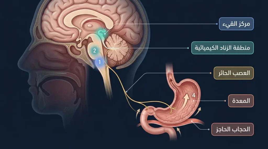 رسم توضيحي طبي واقعي يوضّح آلية حدوث القيء من مركز القيء في جذع الدماغ عبر العصب الحائر إلى المعدة مع تسميات عربية