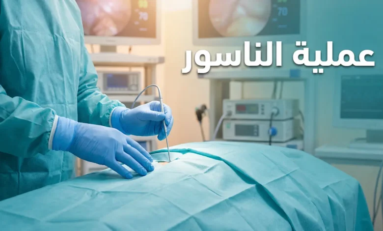 صورة غلاف طبية احترافية تعرض بيئة جراحية حديثة ونظيفة مع عنوان عملية الناسور باللغة العربية