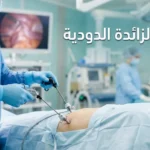 صورة غلاف توضيحية لمقال عملية الزائدة الدودية تظهر يدي جراح تحمل أدوات المنظار في بيئة جراحية حديثة ونظيفة.