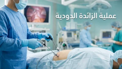 صورة غلاف توضيحية لمقال عملية الزائدة الدودية تظهر يدي جراح تحمل أدوات المنظار في بيئة جراحية حديثة ونظيفة.