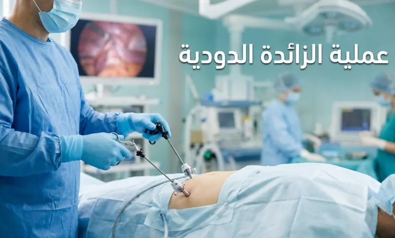 صورة غلاف توضيحية لمقال عملية الزائدة الدودية تظهر يدي جراح تحمل أدوات المنظار في بيئة جراحية حديثة ونظيفة.
