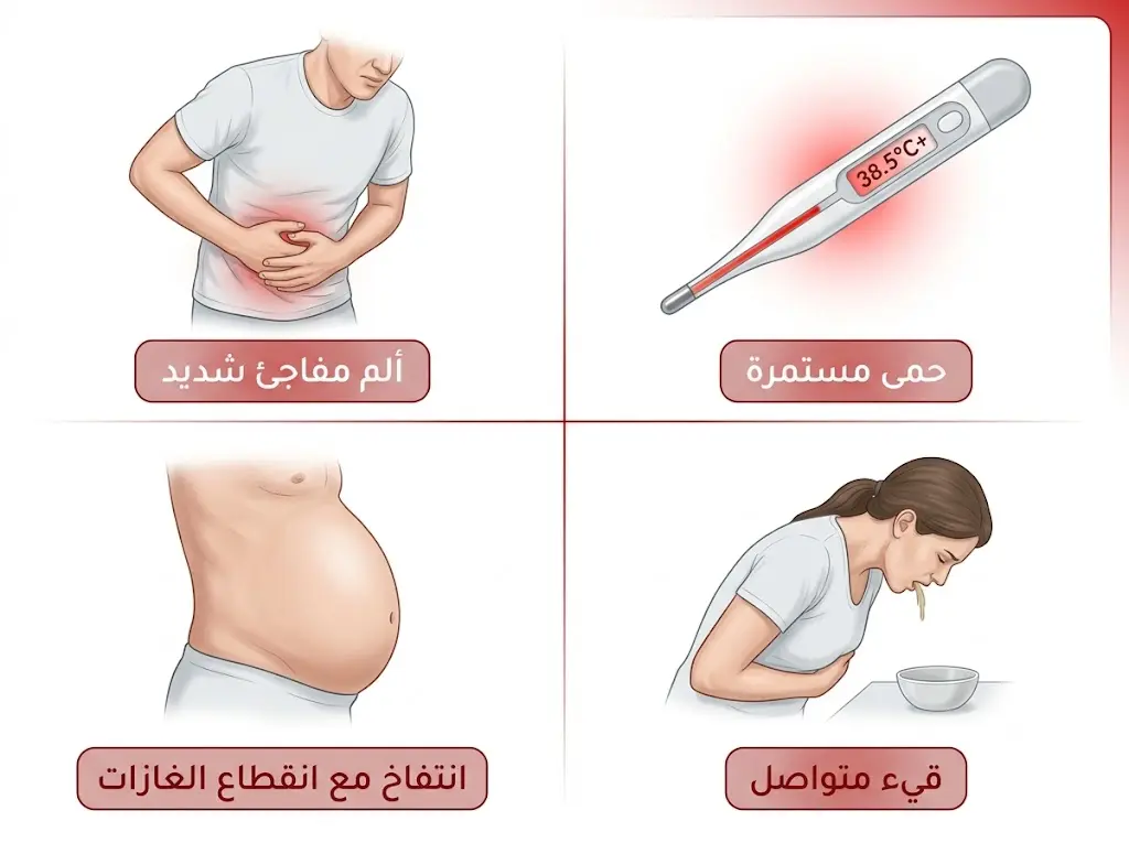 رسم طبي توضيحي يعرض أربع علامات تحذيرية خطيرة بعد عملية الزائدة الدودية تستوجب زيارة الطوارئ: الحمى المستمرة والألم المفاجئ والقيء المتواصل والانتفاخ مع انقطاع الغازات.