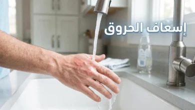 إسعاف الحروق — يد تحت ماء جارٍ بارد من صنبور المطبخ لتبريد حرق سطحي من الدرجة الأولى كإجراء إسعافات أولية صحيح