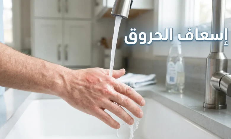 إسعاف الحروق — يد تحت ماء جارٍ بارد من صنبور المطبخ لتبريد حرق سطحي من الدرجة الأولى كإجراء إسعافات أولية صحيح