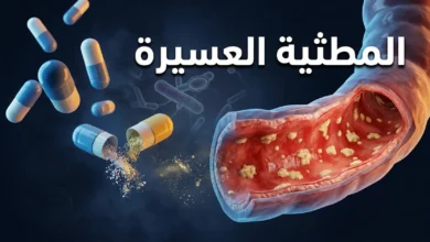 صورة غلاف طبية ثلاثية الأبعاد تُظهر مقطعاً عرضياً لقولون ملتهب مع أغشية كاذبة وكبسولات مضادات حيوية متناثرة وبكتيريا المطثية العسيرة في الخلفية.
