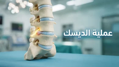 صورة غلاف توضح نموذجاً تشريحياً واقعياً للعمود الفقري القطني مع انزلاق غضروفي في الفقرة L4-L5 وعبارة عملية الديسك