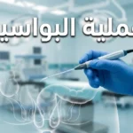 صورة غلاف احترافية لمقال عملية البواسير تظهر بيئة غرفة عمليات نظيفة مع أداة جراحية حديثة وتوضيح تشريحي شفاف للبواسير