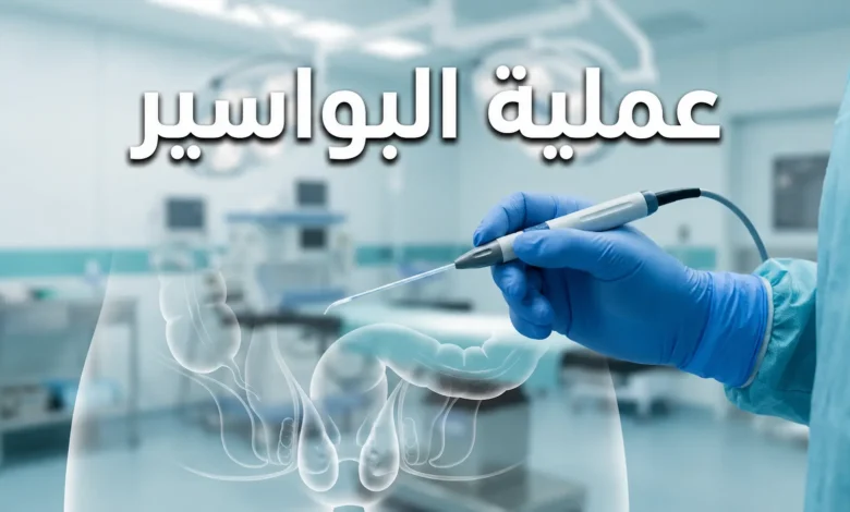 صورة غلاف احترافية لمقال عملية البواسير تظهر بيئة غرفة عمليات نظيفة مع أداة جراحية حديثة وتوضيح تشريحي شفاف للبواسير