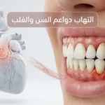 صورة طبية ثلاثية الأبعاد تُظهر التهاب دواعم السن مع إبراز العلاقة المحتملة بين بكتيريا اللثة والصمام الأبهري في القلب.