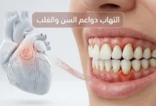 صورة طبية ثلاثية الأبعاد تُظهر التهاب دواعم السن مع إبراز العلاقة المحتملة بين بكتيريا اللثة والصمام الأبهري في القلب.